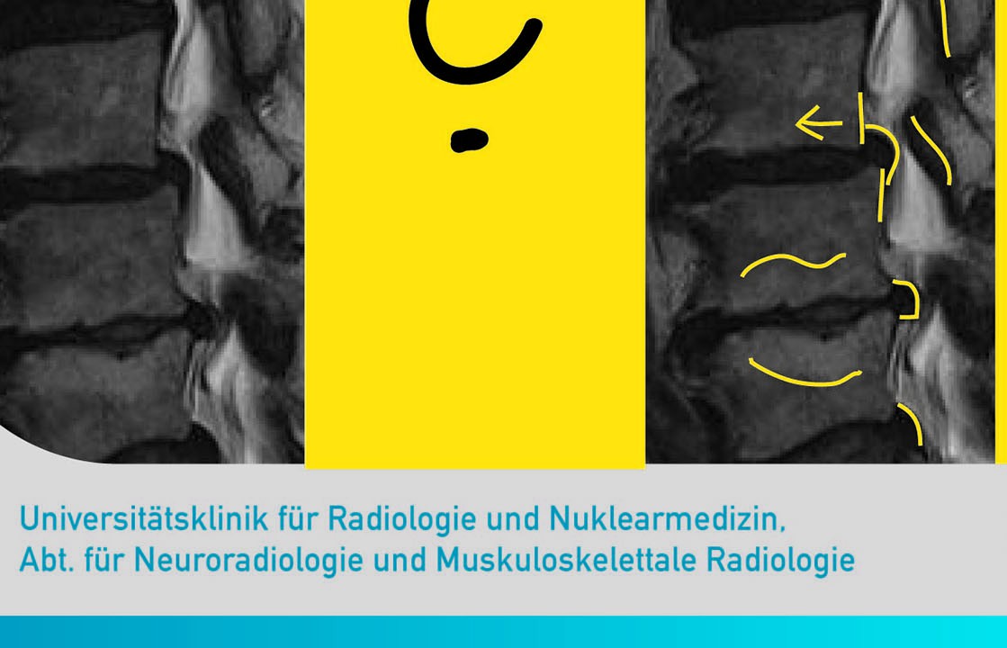 radiologisches diagnosetraining